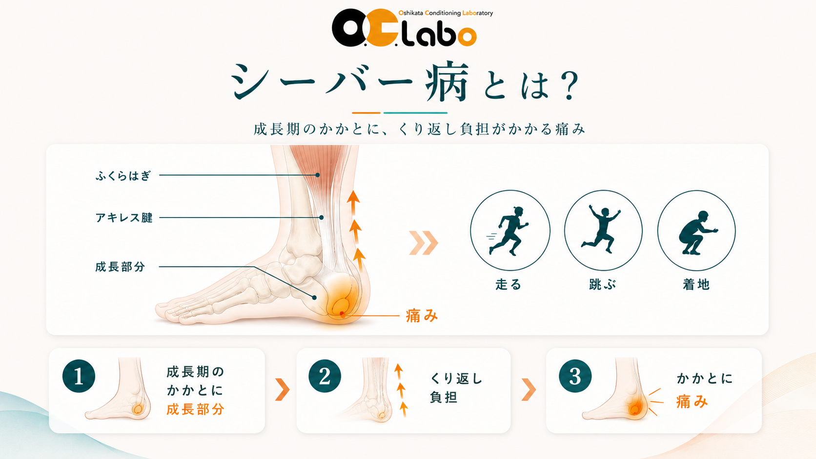 成長期のかかとの成長部分にアキレス腱から繰り返し負担がかかるシーバー病の仕組み