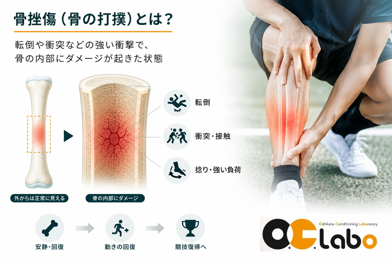 正常な骨と骨挫傷による骨内部の損傷の違いを示した図