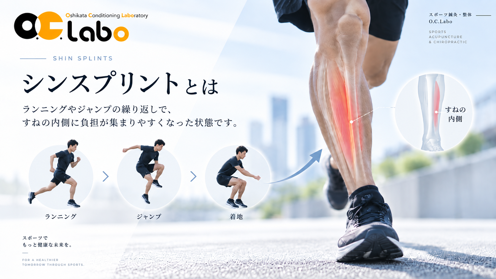 ランニングやジャンプで負担が加わるシンスプリント