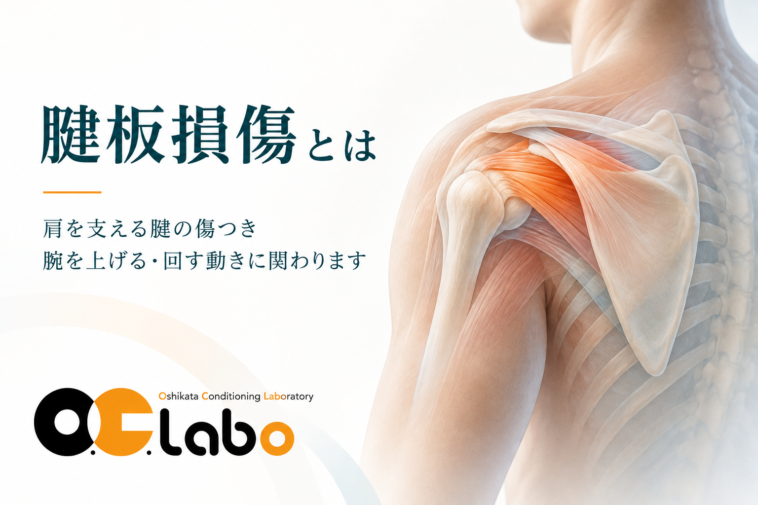 腱板損傷・腱板断裂とは