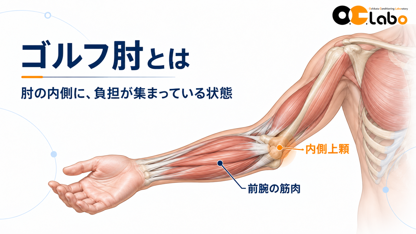 ゴルフ肘とは
